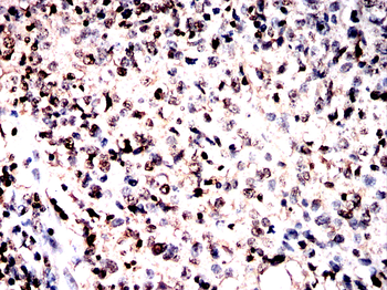 ABL1 Antibody