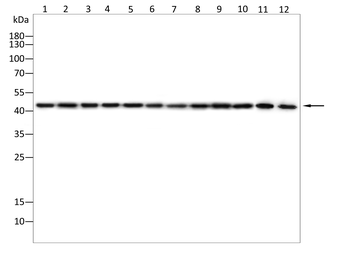 IL11RA Antibody