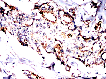 CLDN6 Antibody