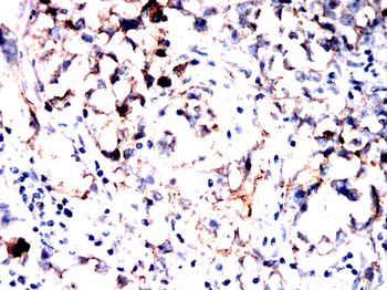 CLDN6 Antibody
