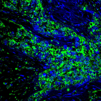 CAND1 Antibody