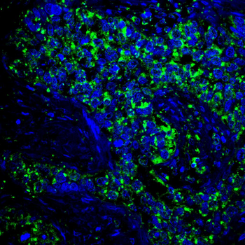 CAND1 Antibody