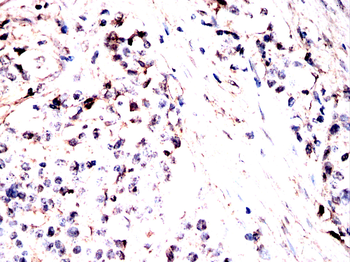 CAND1 Antibody