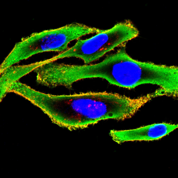 POSTN Antibody