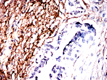 POSTN Antibody