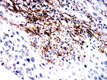 POSTN Antibody
