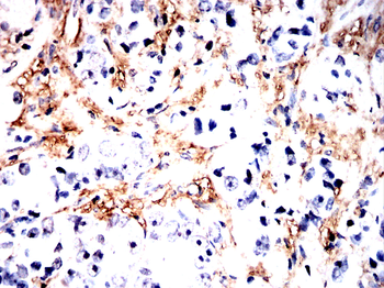 POSTN Antibody
