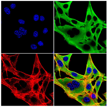 ERBB3 Antibody
