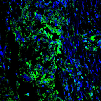 EP300 Antibody