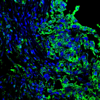 EP300 Antibody