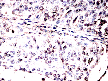EP300 Antibody