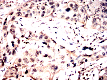 EP300 Antibody