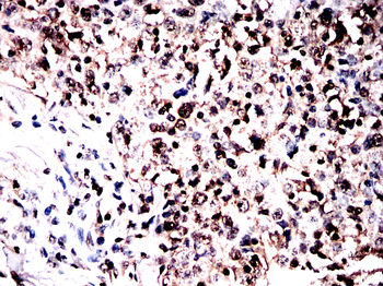 EP300 Antibody