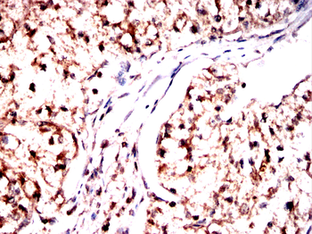 EP300 Antibody