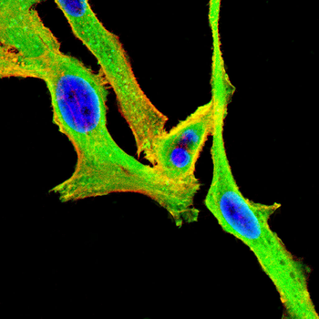 ACSL4 Antibody