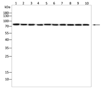 ACSL4 Antibody