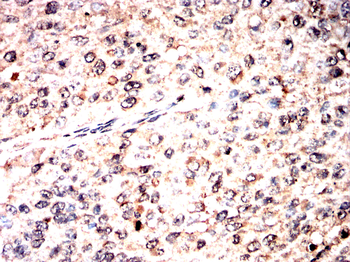 MAP2K7 Antibody