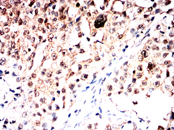 MAP2K7 Antibody