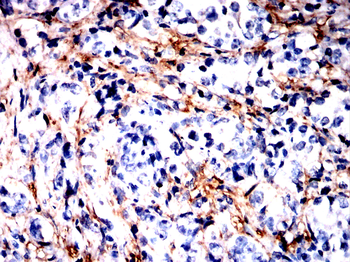 MAP2K7 Antibody