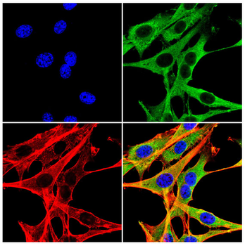 S100A14 Antibody