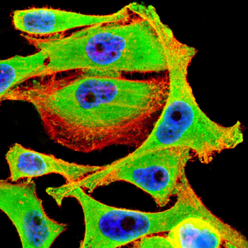 S100A14 Antibody