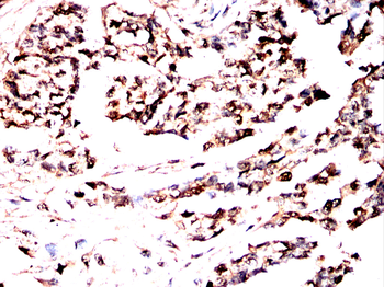 IDH2 Antibody