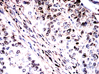 IDH2 Antibody
