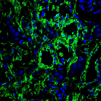 IDH2 Antibody
