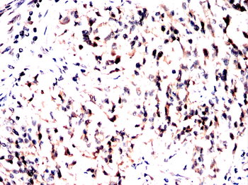 IDH2 Antibody