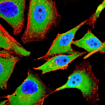 VPS28 Antibody