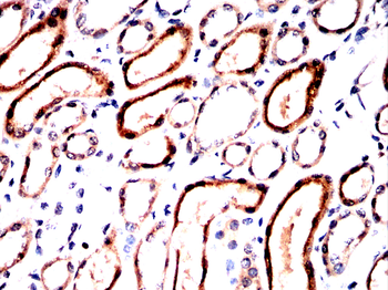 CIP2A Antibody