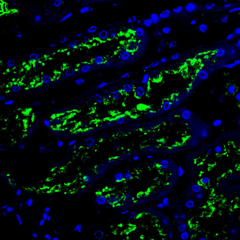 CIP2A Antibody