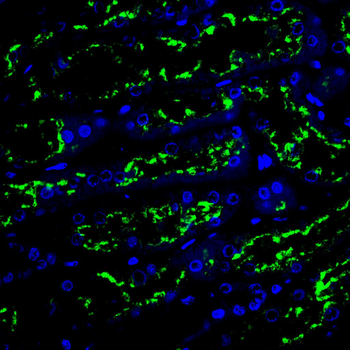 CIP2A Antibody