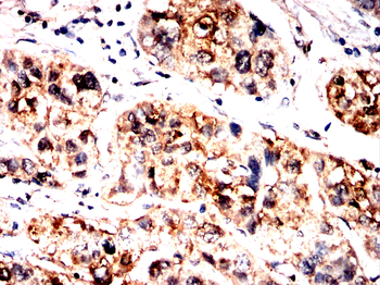 CIP2A Antibody
