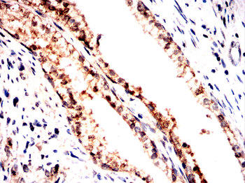 CIP2A Antibody