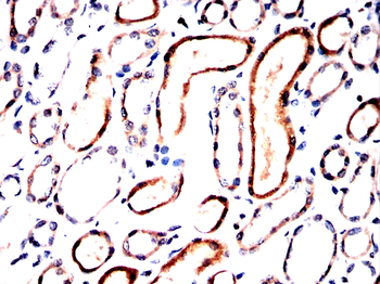 CIP2A Antibody