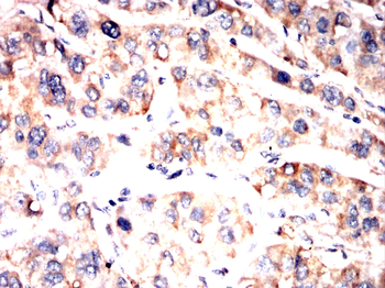 CIP2A Antibody