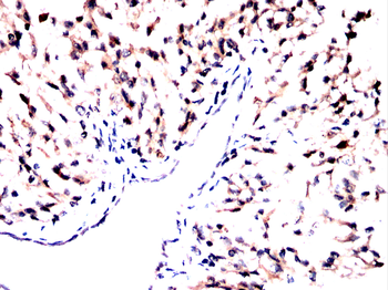 CIP2A Antibody
