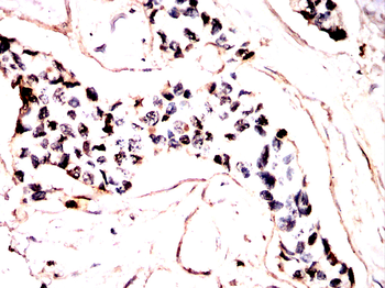 BATF3 Antibody