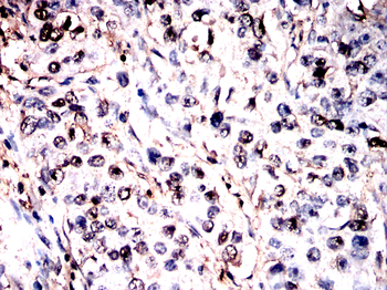 BATF3 Antibody