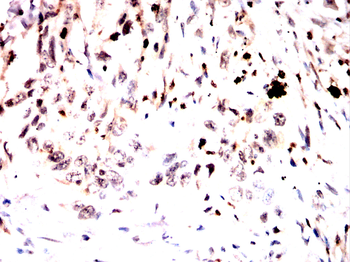 BATF3 Antibody