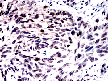 GNAQ Antibody