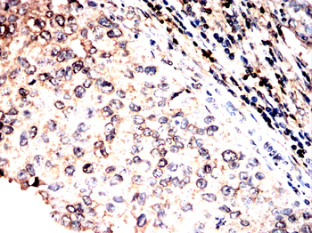 IL13RA2 Antibody