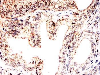 IL13RA2 Antibody