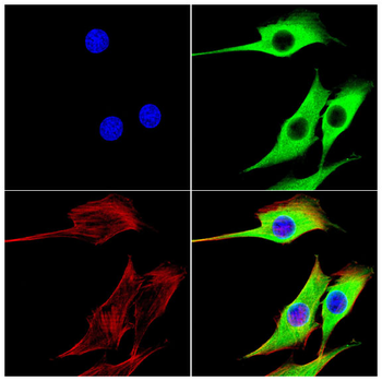 SMS Antibody