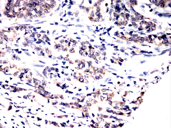 SMS Antibody
