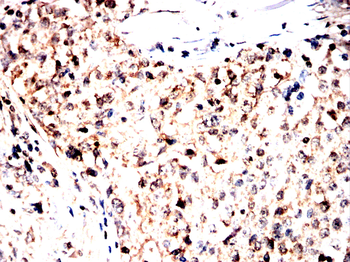 SMS Antibody