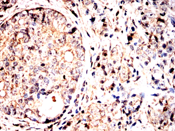 SMS Antibody