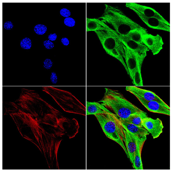 PRKD1 Antibody