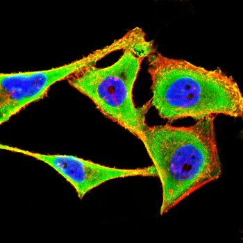 PRKD1 Antibody